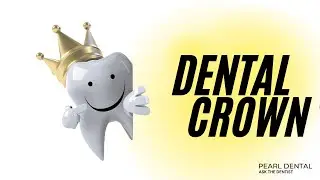 Why to have a Dental crown after Root Canal Treatment : Ask The Dentist