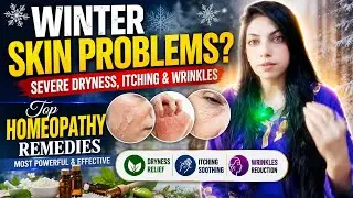 &ldquo;Winter Skin Problems? Severe Dryness, Itching & Wrinkles? Top Homeopathy Remedies That Work!&rdquo;