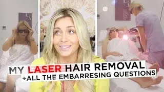 My Laser Away Hair Removal Experience + All the Embarrassing Questions
