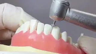 Nano IPR Bur