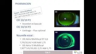 2016 01 14 20 30 1  Cas cliniques   pour débuter