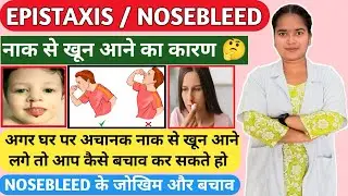 NOSEBLEED | TYPES | CAUSES & RISK FACTORS | MANAGEMENT | PREVENTION #nosebleed