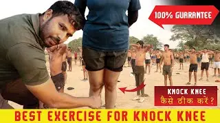 Knock Knee Kaise thik kare 😱| Knock knee Solution | knock knee best exercise | knock knee treatment