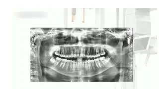 MY-D065B-N1: 4-in-1 CBCT with Cephalometric - High-Precision Dental Imaging