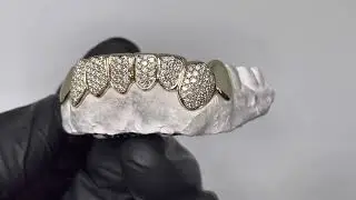 Bottom 6 VS Diamond Grillz w Solid Gold Molars - 100% Solid Gold & Natural Diamonds | Luxe Grillz