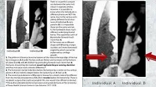 Profile Proof - by Forensic Artist Lois Gibson