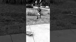 #notclickbait Skateboard breaks kids hand