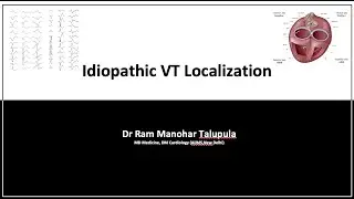 Idiopathic VPC localisation on ECG / Manohar / Cardiology