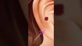 Plastic piece of removal 🔥 by asmr #asmr #plastic #plasticsurgery #short #shorts #ear