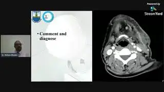 CT Neck - Dr.Hisham Elbadan