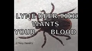 LYME DEER TICK CRAWLING TO INFECT YOU