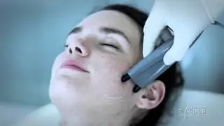 Cuore 8: ¿Cómo funciona la Electroestimulación de Sveltia?