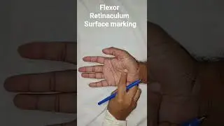 Surface marking of Flexor Retinaculum #anatomy #educational #exam #upperlimb #health