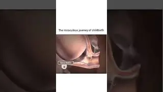 Asmr Child Birth miraculous journey 😳