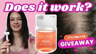 Does the Calecim Advanced Hair System ACTUALLY Work? (+ PRIZE Giveaway!)