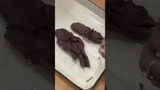 Anatomy - Digestive system 1 | Tongue and pharynx - real preparation | #anatomy #digestivesystem