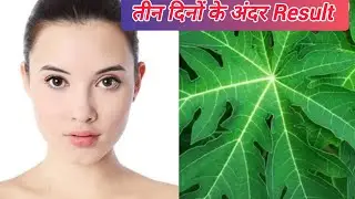 Papaya Leaf Face Pack Pigmentation Dark Spots Remove । Best DIY Homemade remedy