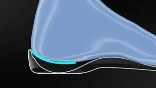 Heel Free