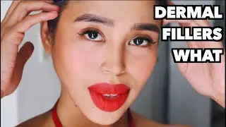 I TRIED DERMAL (LIP AND FACE) FILLERS ft  Restylane and Doc Gaile | Jessica Godinez