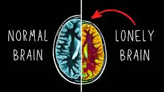 Loneliness Could Be Shrinking Your Brain - Here&rsquo;s Why