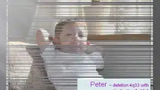 Unique children with rare chromosome disorders