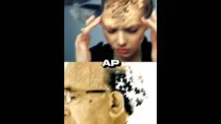 Dementia vs Alzheimer's #shorts