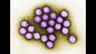 Adenovirus: What is it and why the high percentage of deaths in the NJ outbreak?