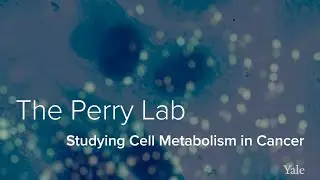 Cancer Metabolism, Glucose, & The Immune System - The Perry Lab at Yale School of Medicine