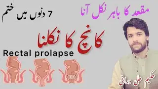 Kanch nikalna | Rectal prolapse Symptoms ,Treatment and causes in Urdu | Maqad ka bahar Ana #hakeem