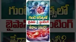 Bypass Stent in Telugu | #bypass #stent #heartblockage #heartattack #hearthealth #healthtips #shorts