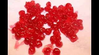 How To Make Candied Cherries – Recipe