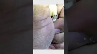 Funny Catching frogs for laugh #frog #funnyanimals #animals #shorts