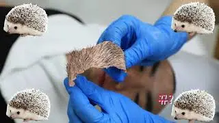 수유왁싱_엠뷰티) 그루밍시대 ! 남자수염왁싱 과연 결과는?