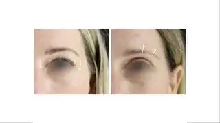 Testimonial | Dr. Athanasiou ABH Medical Group