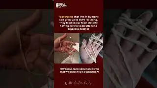 The tapeworms that live in humans can get up to sixty feet long. #healthchannel #doctor #tapeworm