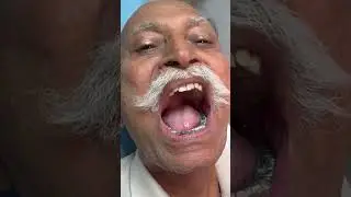 Metal tooth 😈 day23/100 smile back challenge #vivia alvideo a