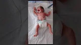 preterm new born baby on nasal cpap In nicu #nicunurse #viralvideo #nicunurse