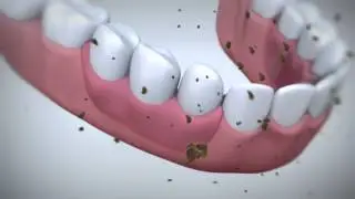 How does Fixodent denture adhesive work?