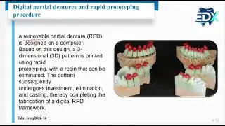 Digital partial dentures مرحلة رابعة-طب الاسنان- lecture5د.زهرة رعد شهاب