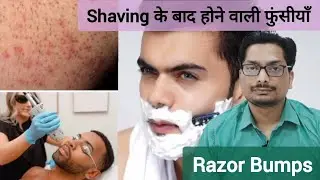 Pimples after shaving | Razor Bumps Treatment | Pseudofolliculitis Barbae #razorbumps