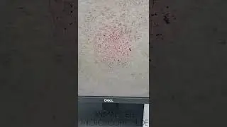 Animal Cell Prepared Microscopic Slide | On A High Magnification Digital Microscope