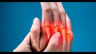 Arthritis Simulator Teaser Trailer (UPCOMING Precision Platformer!!!)