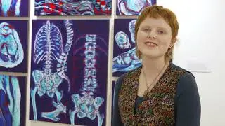 Visual Arts - Body of Work - Ruby Frost - 'Growing Pains'
