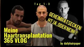 Meine Haartransplantation Tag 1-3 Ankunft, op & Ablauf - DHI SAPHIR 💉 Cosmedica hairtransplant