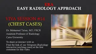 Viva session # 14 (Chest cases -cystic lung disease- 3rd part)