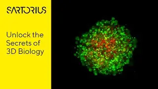 Incucyte&reg; CX3 Live Cell Analysis System featuring Confocal Fluorescence Imaging