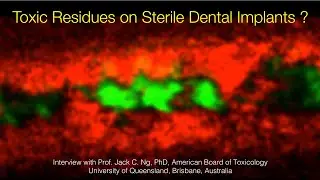 Toxicity of Implant Impurities and the Precautionary Principle in Implant Dentistry