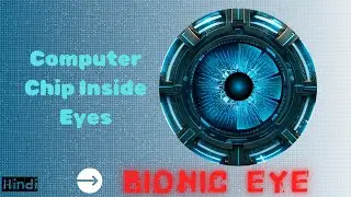 Finally! Elon Musk's BIONIC EYES is Here | Computer Chip Inside Eyes || IN HINDI @AI_FusionHub