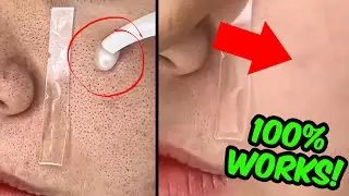 How To REMOVE Large Open Pores From Face & Nose Permanently Naturally At Home