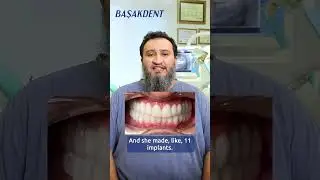 Best Dental Experience: Patient Testimonial | Smile Design | Implant Treatment In Turkey